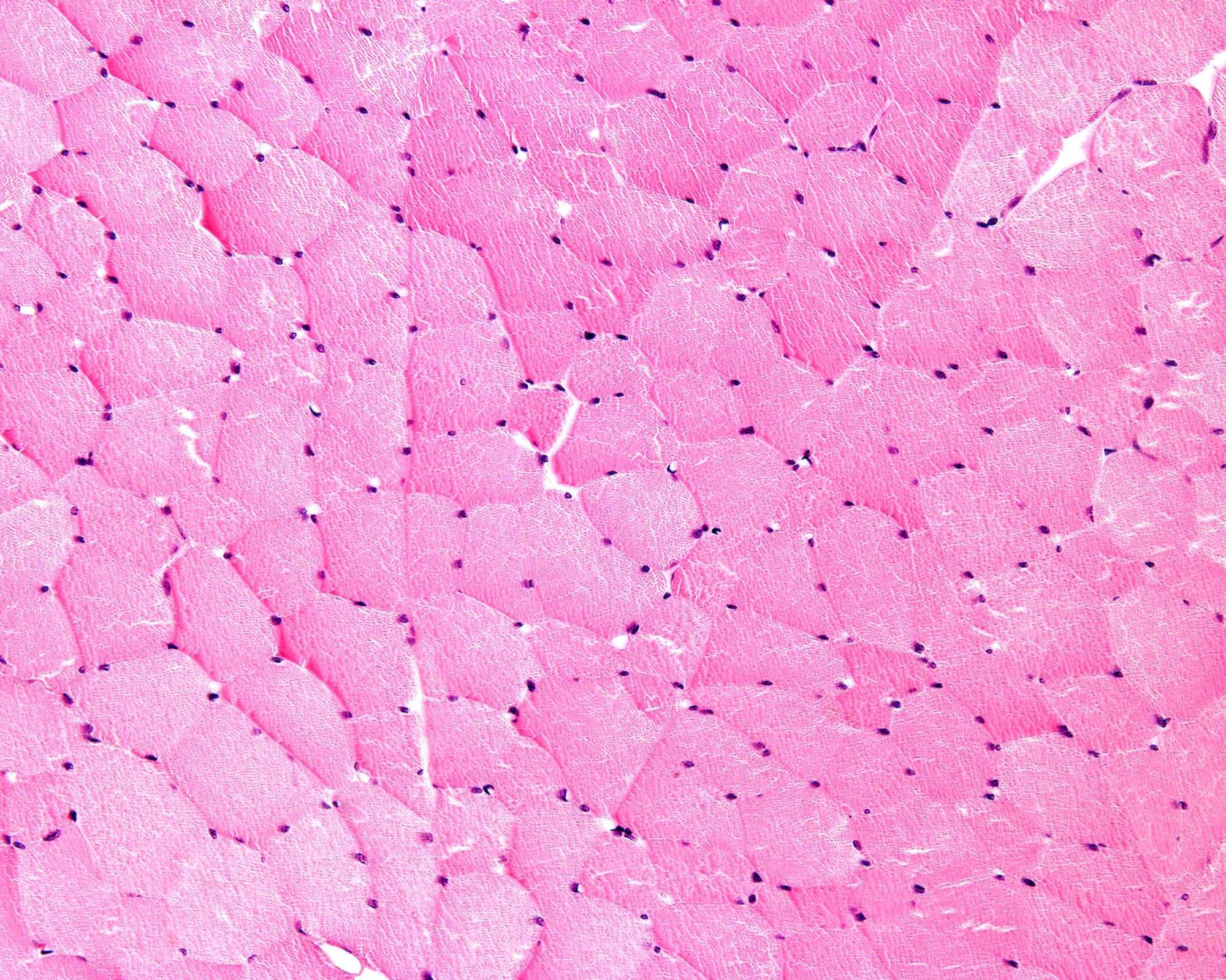 Transverse (cross-section)