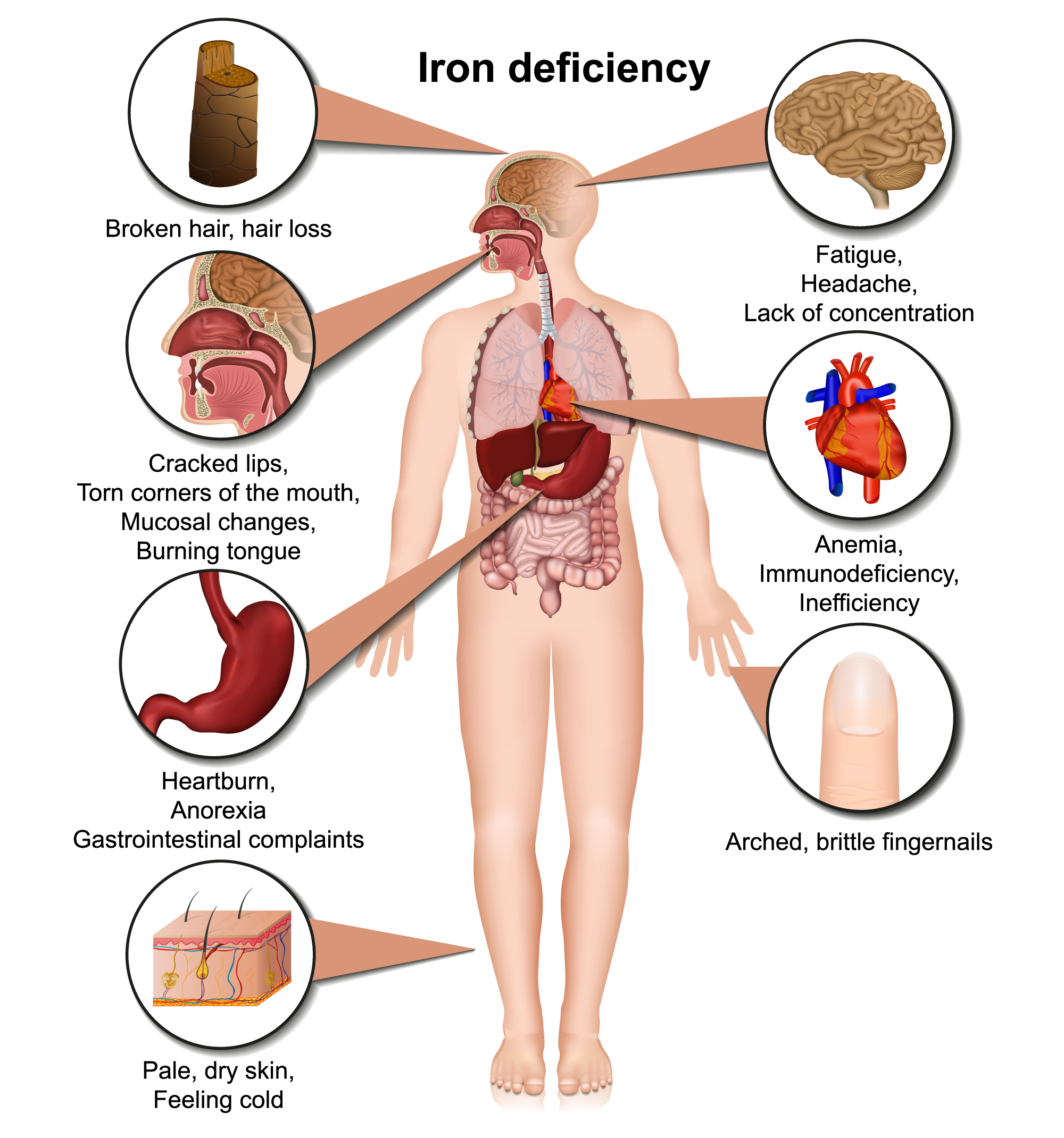 3a2 Digestive Disorders