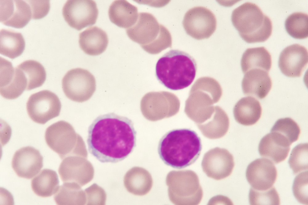 Smaller than the other WBCs, this cell is mostly nucleus with very little visible cytoplasm.  When activated, these cells have a variety of methods for destroying pathogens.