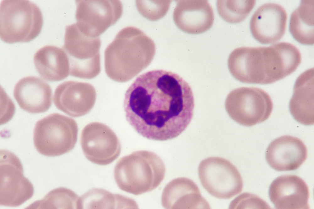 This cell is one of the three granulocytes, along with eosinophils and basophils.  Neutrophils have vesicles that do not pick up much stain.  Their role is to eat up debris in a wound, including pathogens.