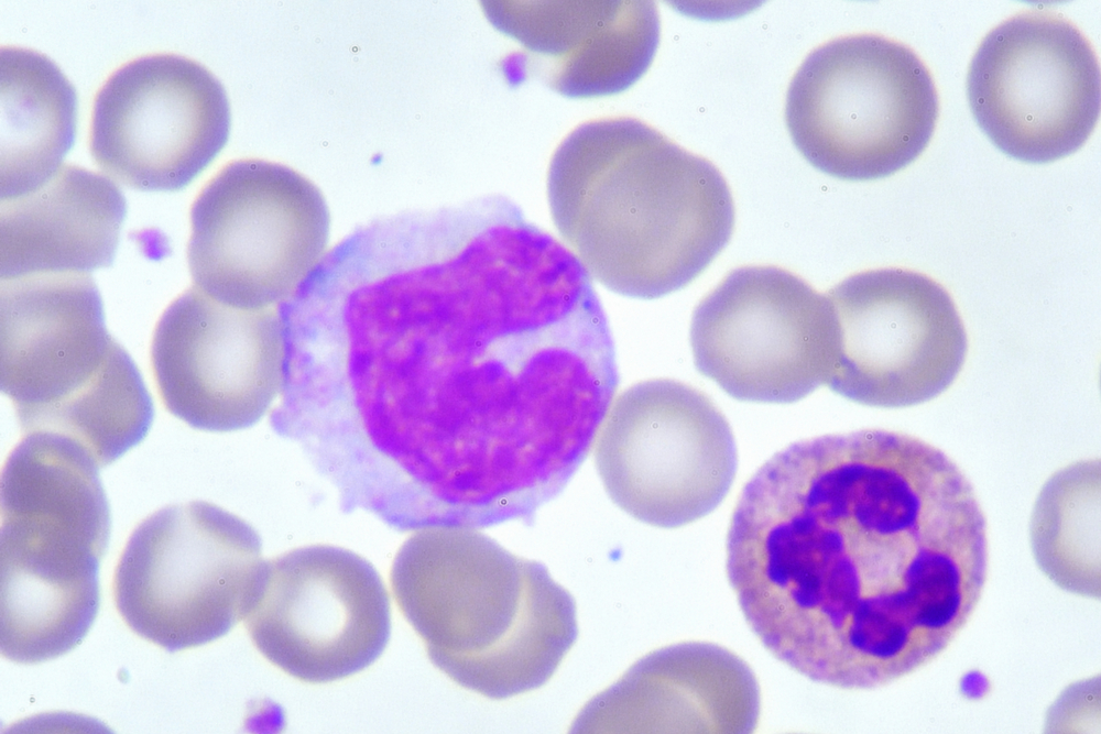 This is the largest of the WBCs with a large nucleus that sometimes looks like it has a dent in it.  Monocytes can eat debris, including pathogens and play a critical role in activating other WBCs to attack pathogens.