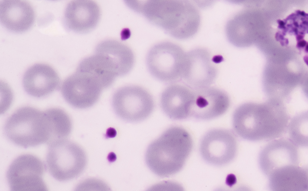 Once part of a larger cell in the bone marrow, each platelet has the potential to form part of a fibrin clot.