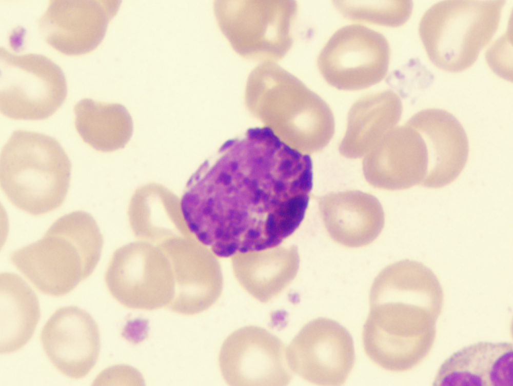 A type of granulocyte with blue-staining vesicles.  The chemicals in these vesicles can activate a large inflammation response against parasites.